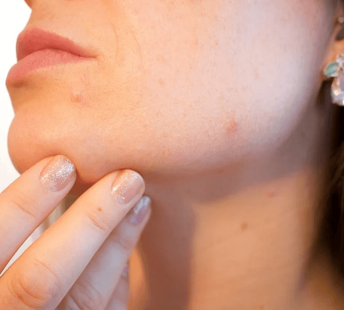 alergi kulit saat hamil