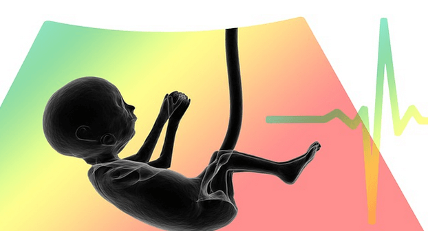 bayi meninggal dalam kandungan