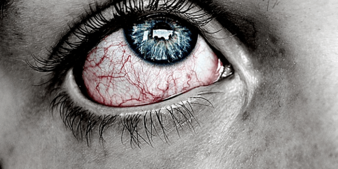 sakit mata pada anak