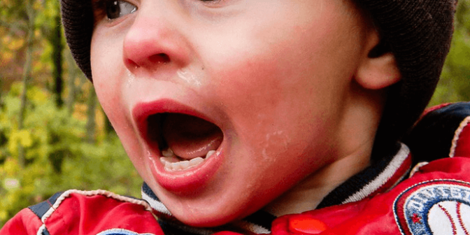 sakit mata pada anak