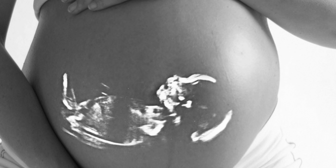 bayi meninggal dalam kandungan