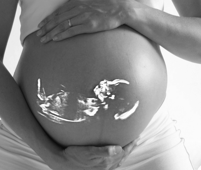 bayi meninggal dalam kandungan