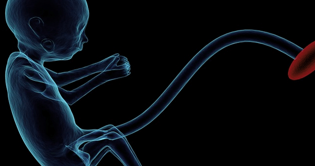 bayi meninggal dalam kandungan