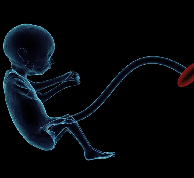 bayi meninggal dalam kandungan