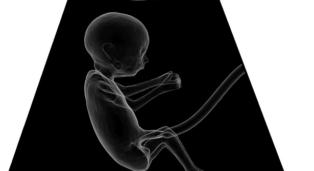 bayi meninggal dalam kandungan