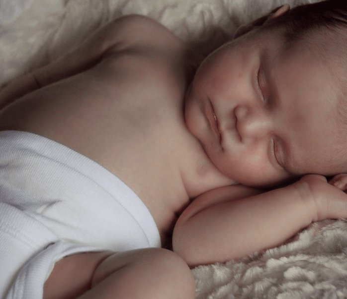 perut kembung pada bayi