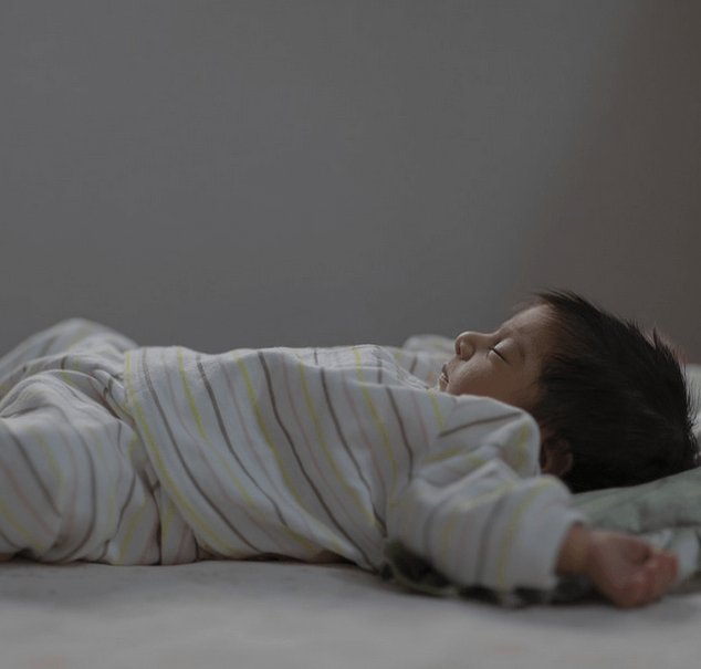 perut kembung pada bayi