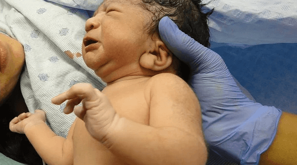 korset setelah melahirkan Caesar