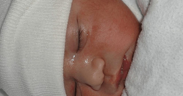 bayi lahir dalam kantung ketuban