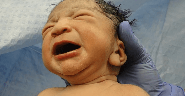 bayi lahir dalam kantung ketuban