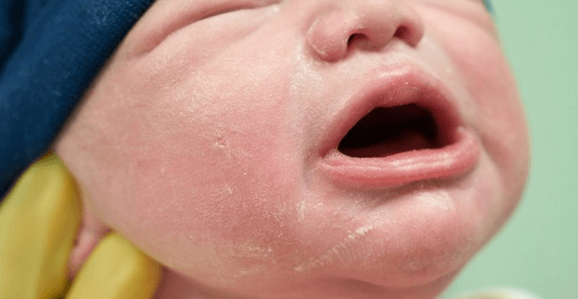 merk obat demam anak 1 tahun