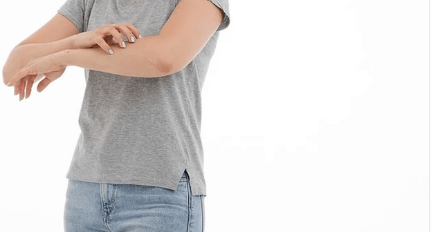 alergi kulit saat hamil