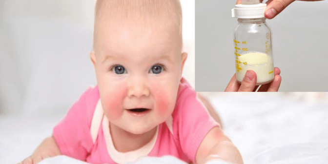 Bayi Alergi Susu Sapi