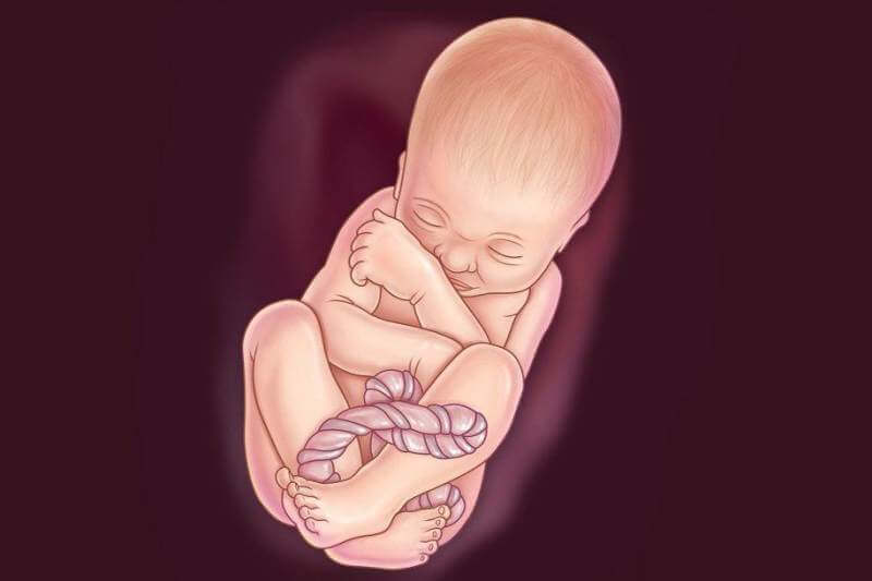 Janin Tidak Bergerak