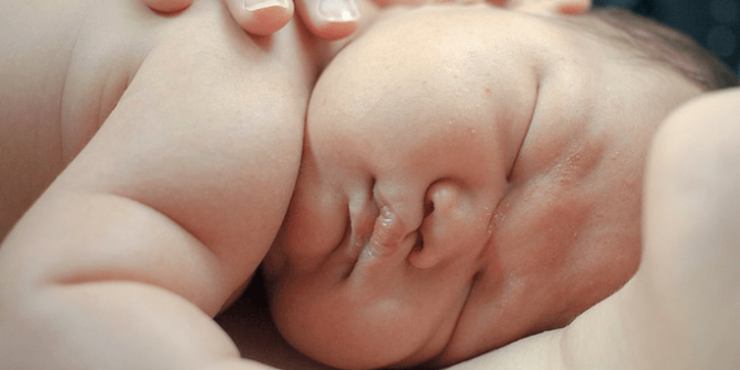 bayi jarang pipis tapi berkeringat