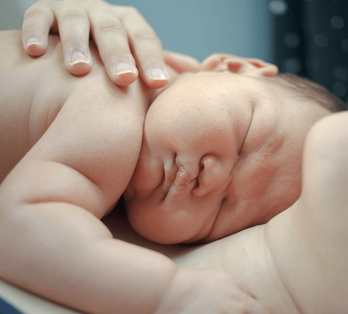 bayi jarang pipis tapi berkeringat