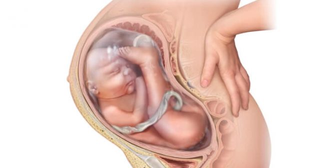 posisi bayi melintang