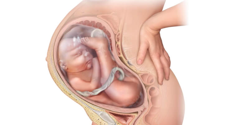 posisi bayi melintang