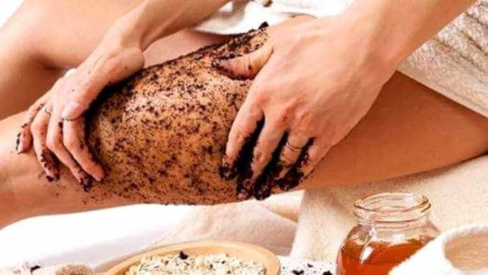 Beda Selulit dan Stretchmark 