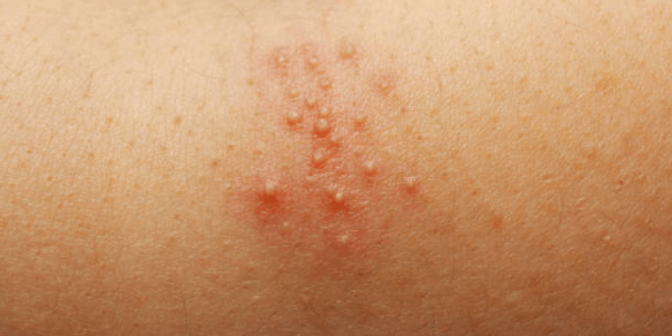 Bedak Bayi Cussons 4