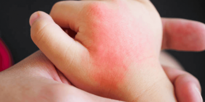 Bedak Bayi My Baby 3