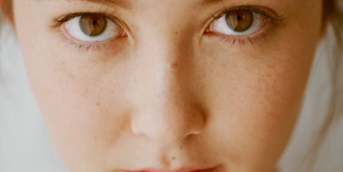 ciri-ciri orang hamil dari raut wajah