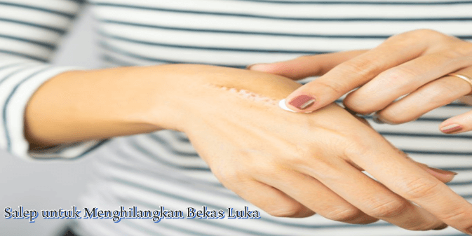 Salep untuk Menghilangkan Bekas Luka