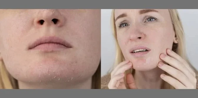 Manfaat moisturizer Pigeon 