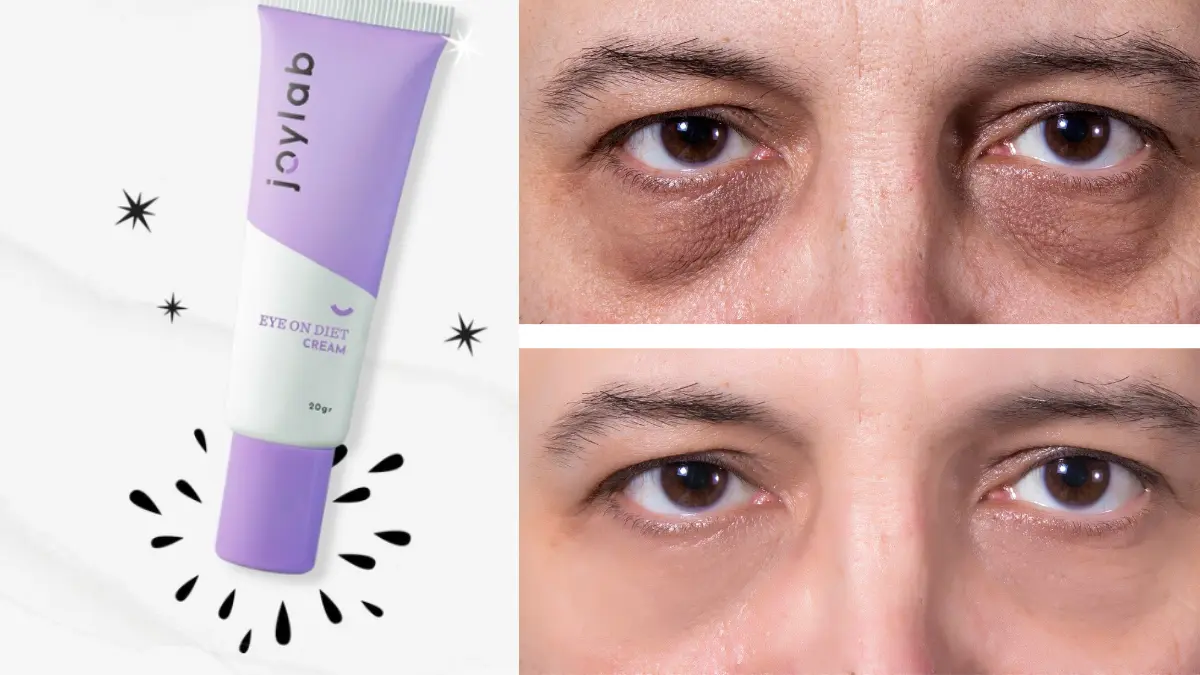 eye cream untuk remaja