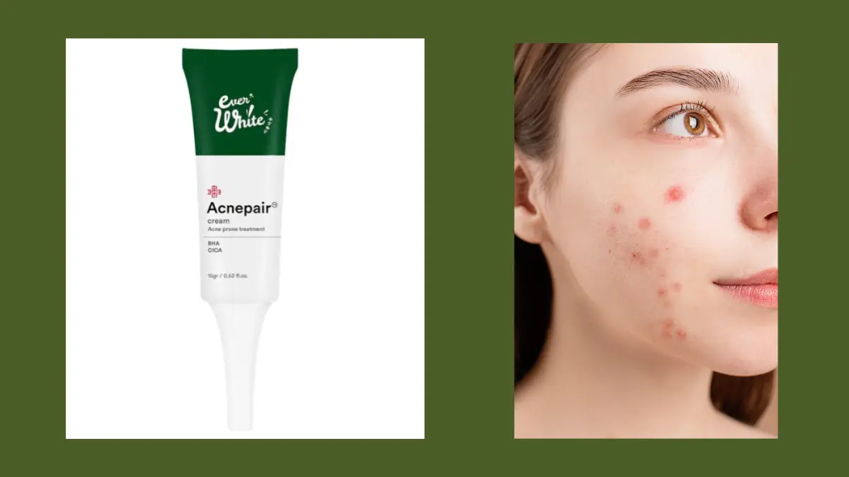 Obat penghilang bekas jerawat