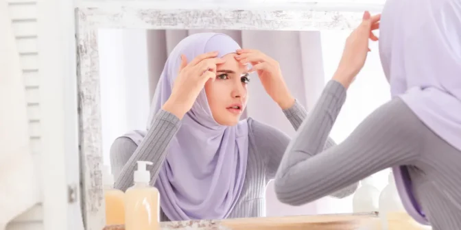 Obat penghilang bekas jerawat