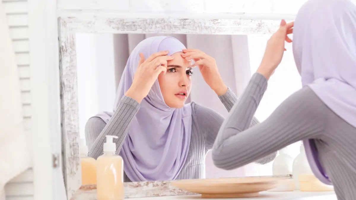 Obat penghilang bekas jerawat