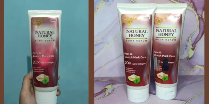 cara menghilangkan stretch mark saat hamil