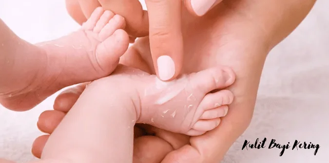 Kulit Bayi Kering