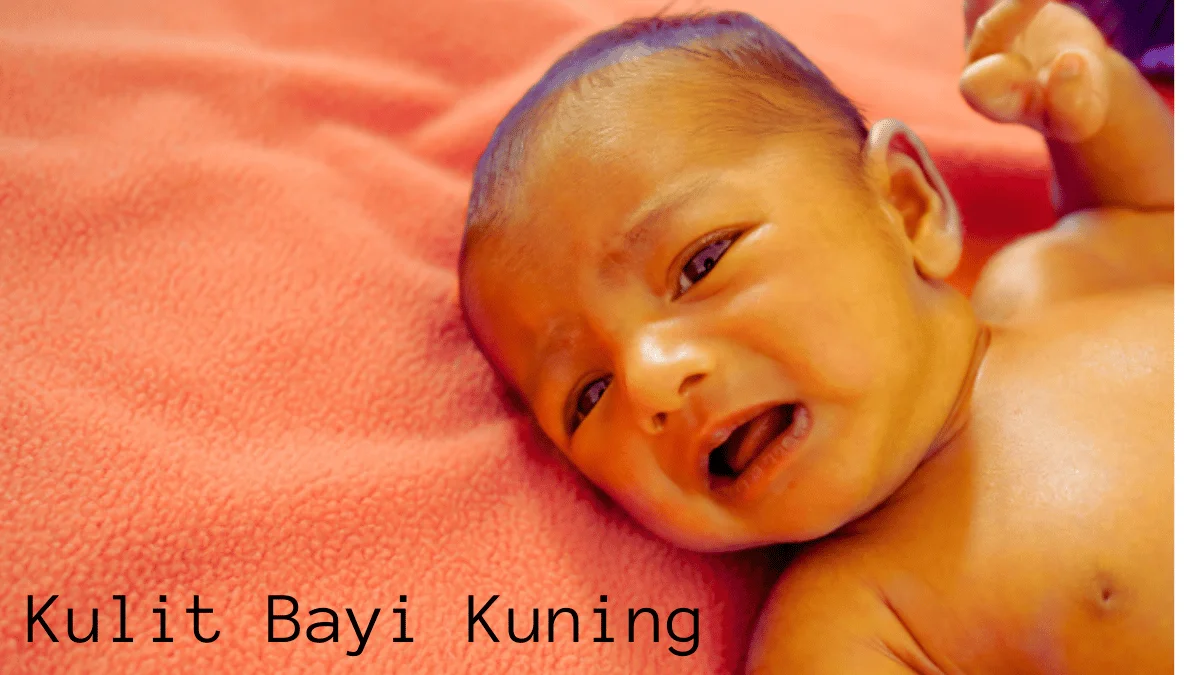 Kulit Bayi Kuning