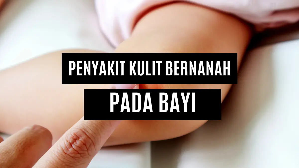 8 Penyakit Kulit Bernanah pada Anak dan Cara Mengobatinya