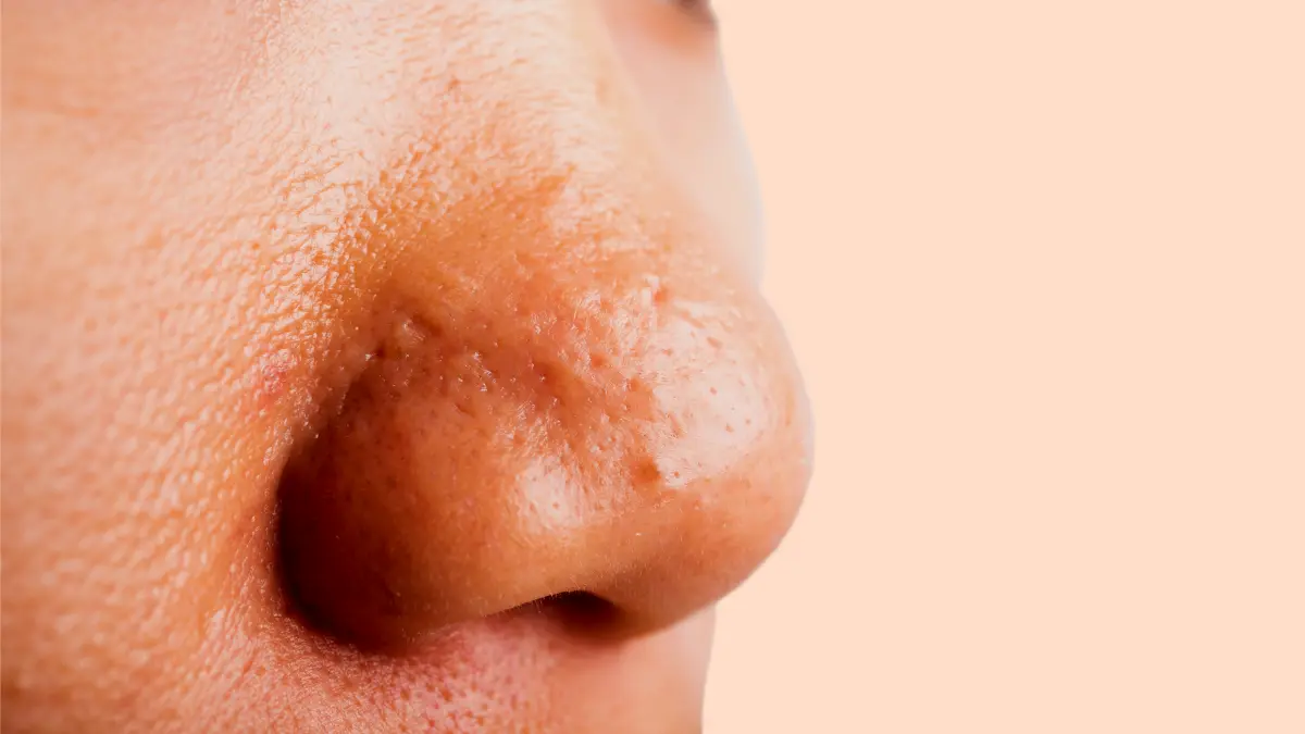 Moisturizer Scarlett