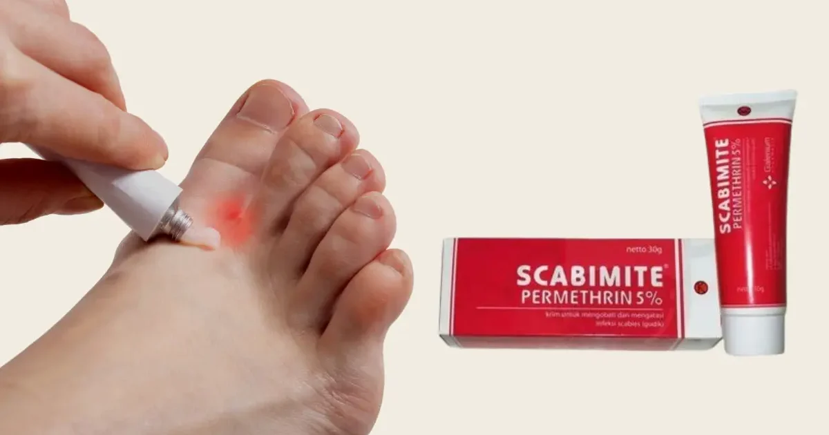 Scabimite Cream