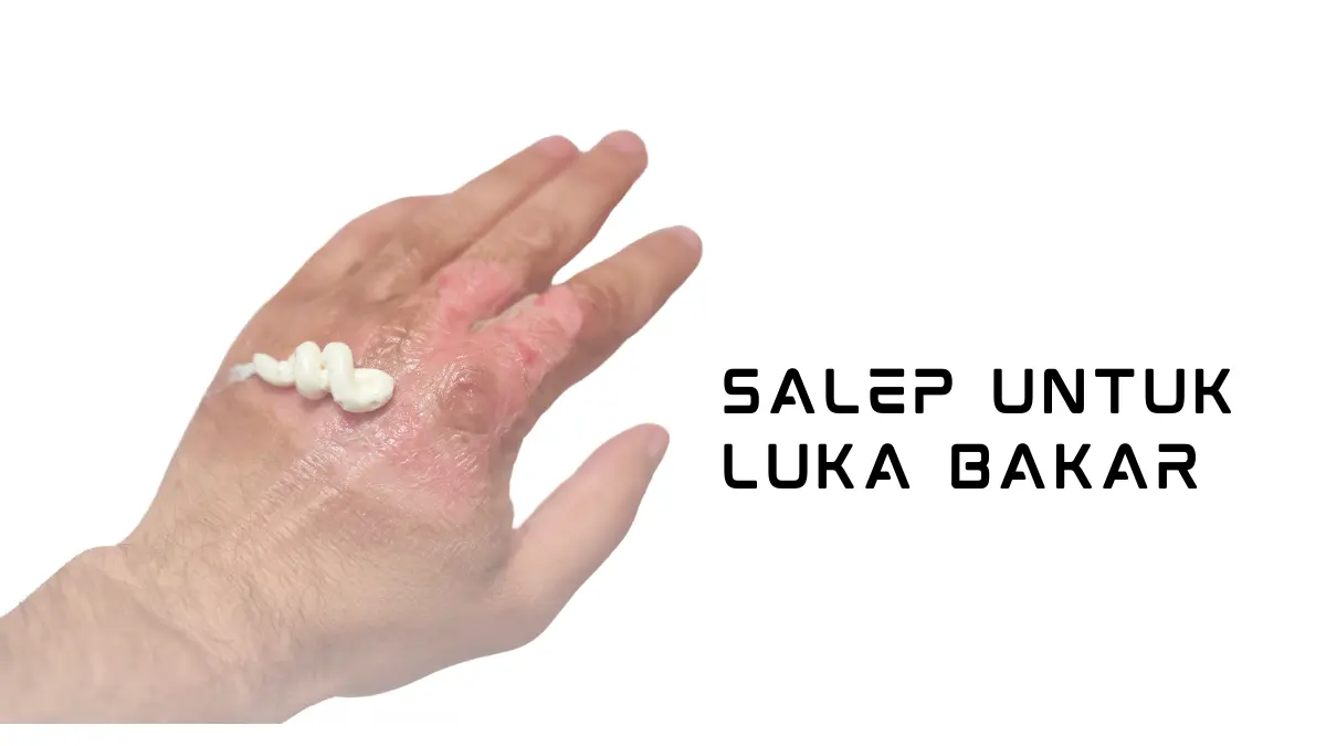 Pasti Manjur! 9 Salep untuk Luka Bakar dengan Harga Terjangkau