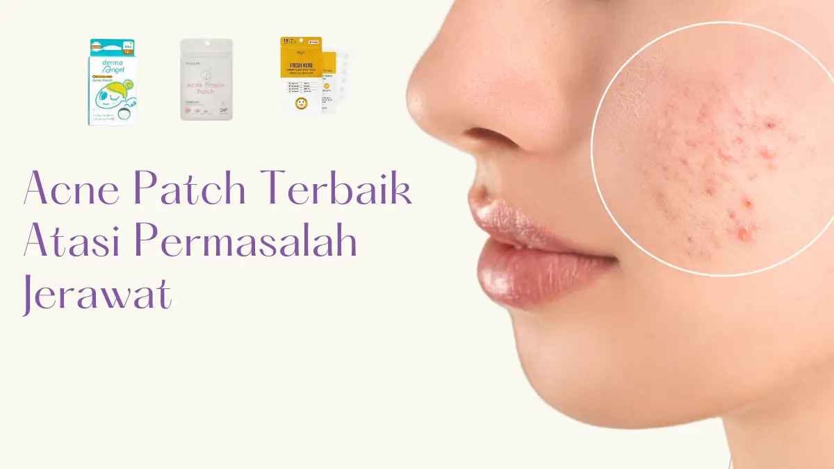 7 Merk Acne Patch Terbaik, Ampuh Hilangkan Jerawat Sampai ke Bekasnya