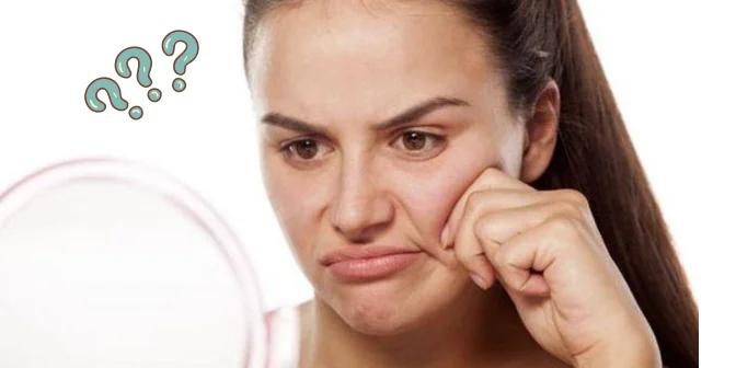 Ciri-ciri wajah kusam